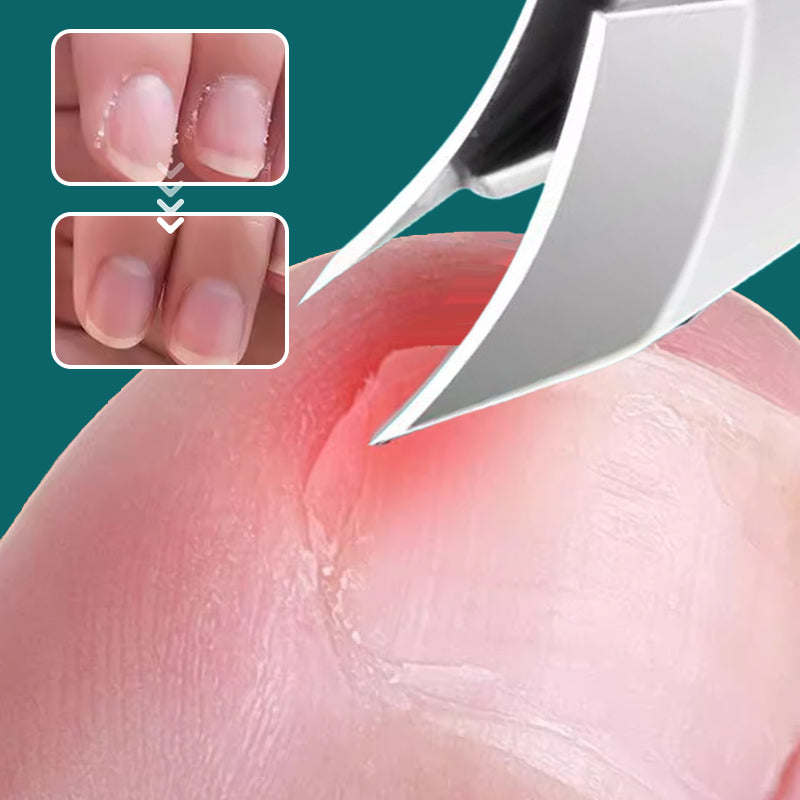 ✨ Lot de 3 coupe-ongles anti-éclaboussures — En acier inoxydable ✨ Pour vos soins à la maison ou en voyage, tout ce qu'il vous faut dans un seul lot ! 💡