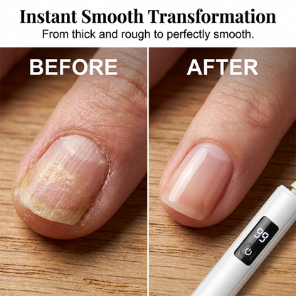 💎 50 % DE RÉDUCTION EN CE MOMENT ! ✨Polisseuse à ongles électrique professionnelle